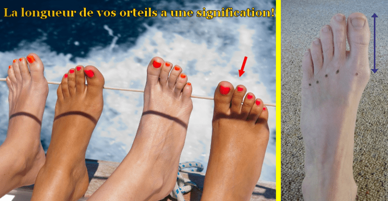 orteil1