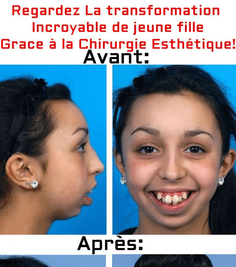 1sja