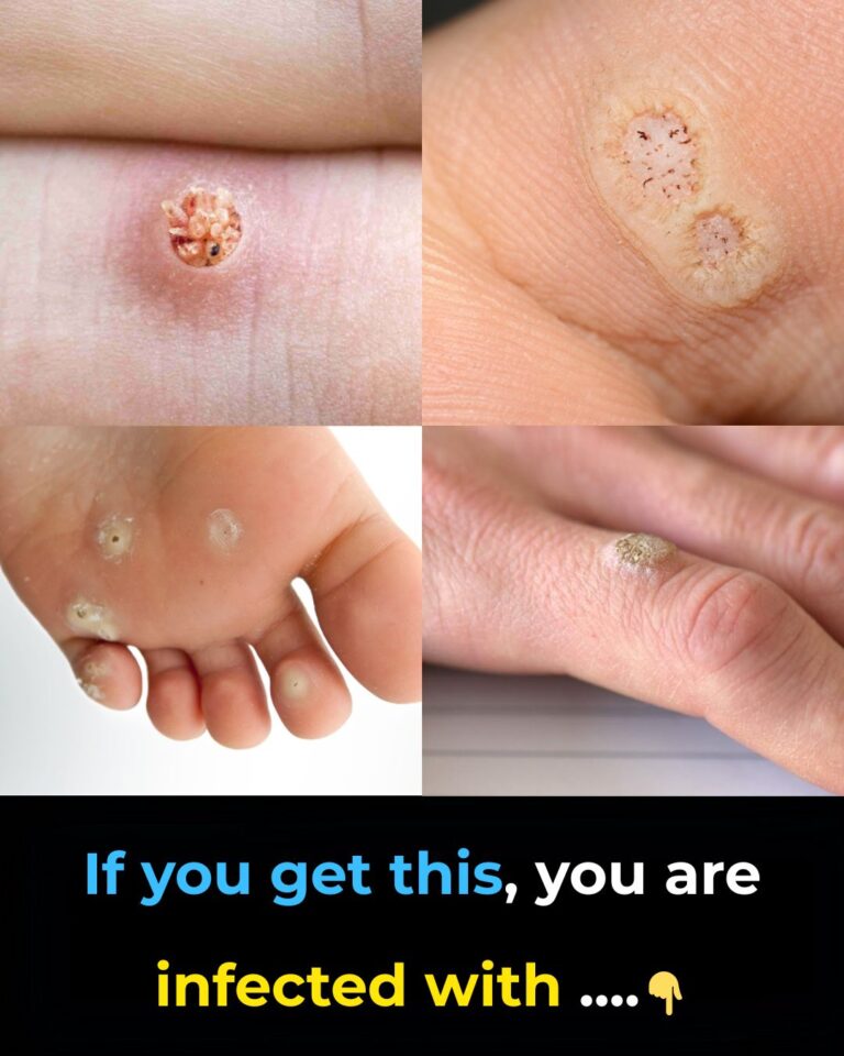 skin-signs