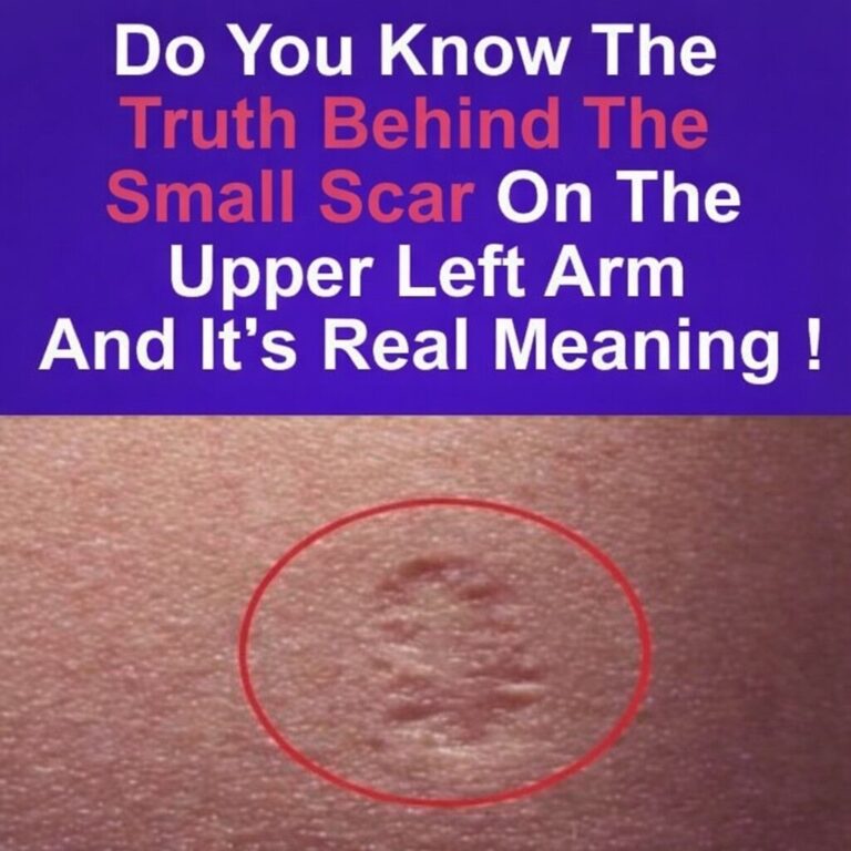 circular mark