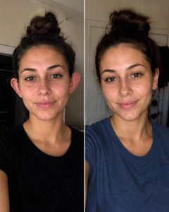 PLASTICSURGERY