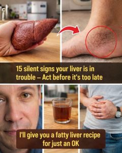 Silent Signs Liver