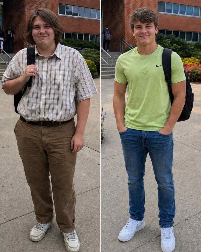 My Son Was Treated Poorly Because of His Looks Throughout His Freshman Year.. After Summer Break, Not Even the teens Who Used to Tease Him Recognized Him, so He Did What He Had Been Planning for Months