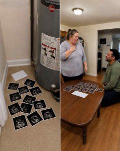 ultrasound